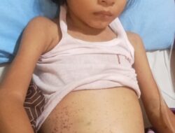 Anak Penderita Leukemia di Simalungun Butuh Uluran Tangan Dermawan